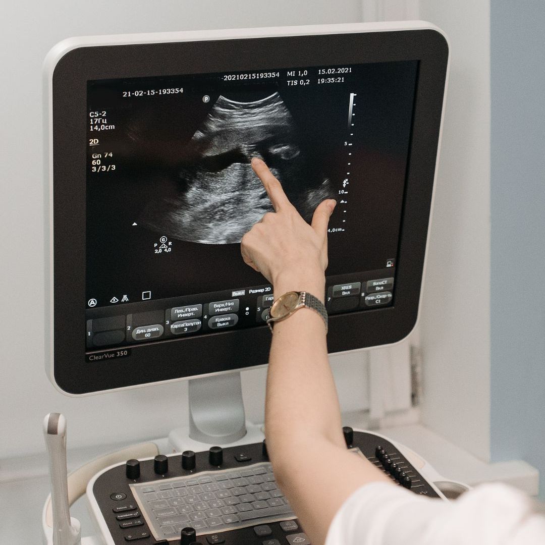 ultrasound machine